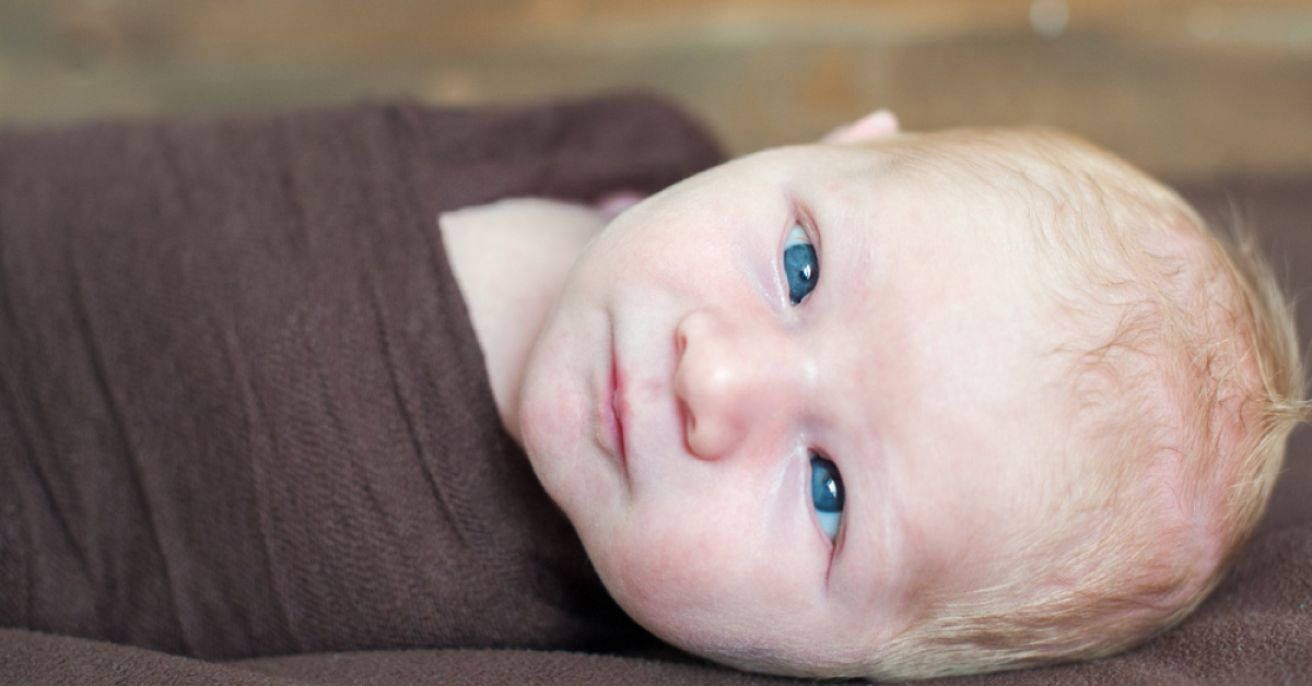 Clinical Presentations Of Bil Alternating Infantile Esotropia