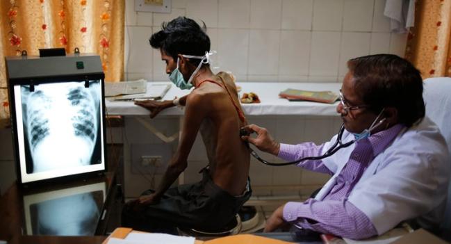 Clinical Trial Supports Shorter Regimen For Multidrug-Resistant TB: NEJM