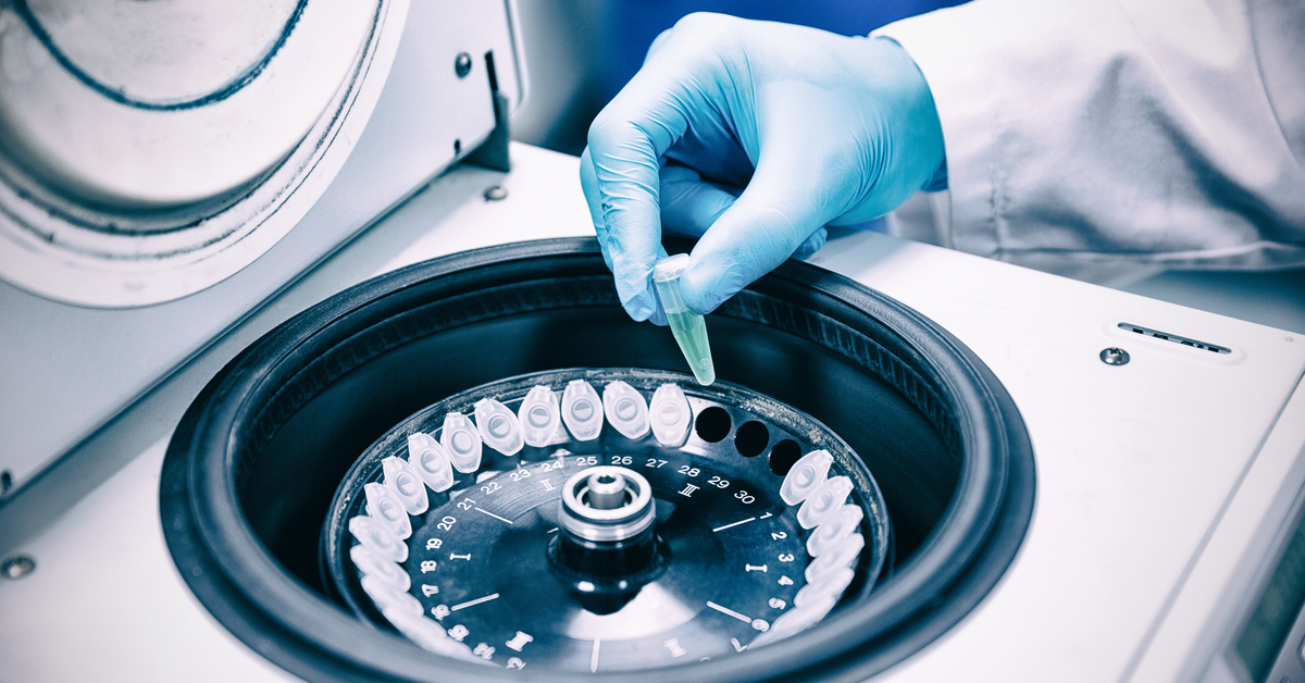 Manual PCV (Packed Cell Volume): Not yet Obsolete