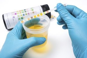 Antibiotics Not Needed Always For Bacteria In Urine As Asymptomatic Bacteriuria Occurs