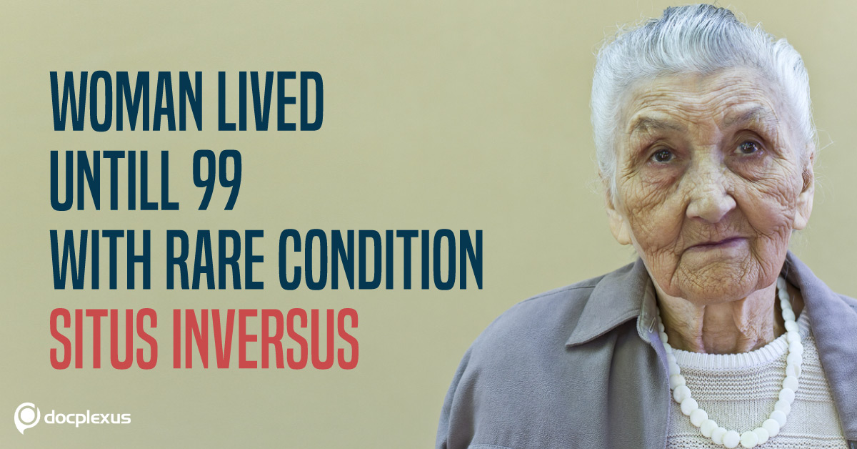 A Rare Case of Situs Inversus