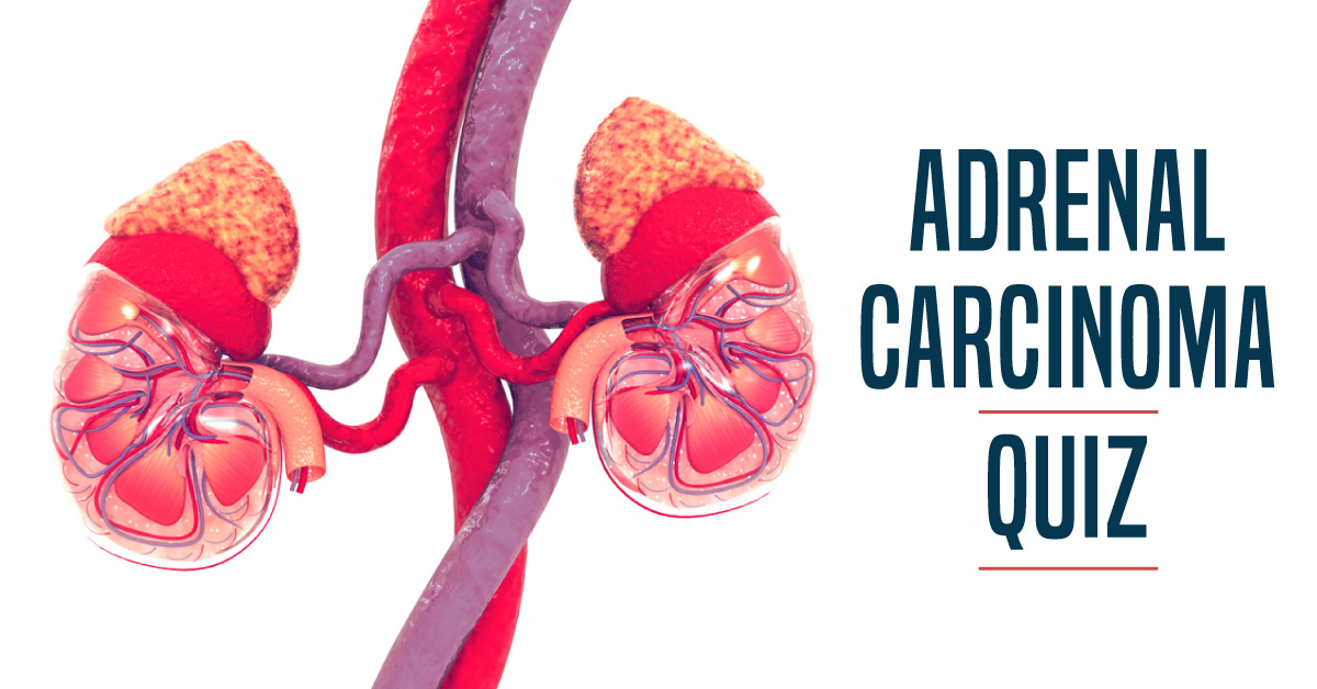 A Quiz on Adrenal Carcinoma