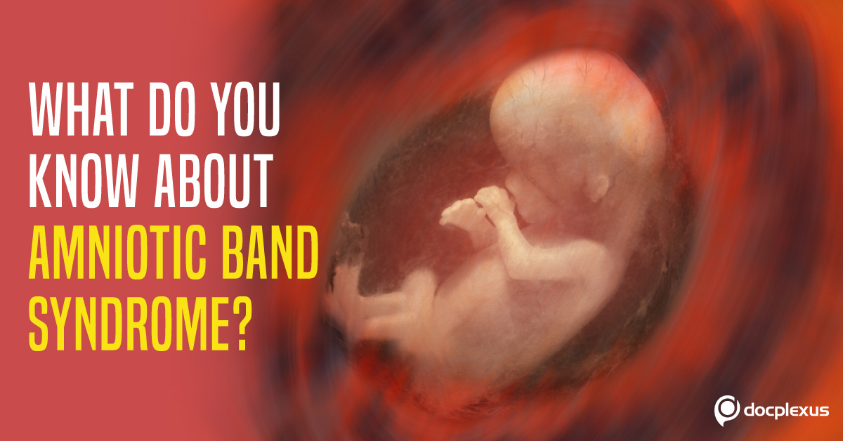 Amniotic Band Syndrome: A Rare Disorder