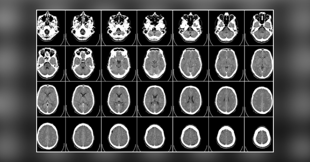 Artificial Intelligence Can Now Manipulate Medical Images Well Enough To Kill People