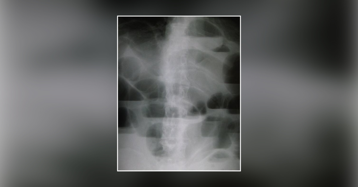 Diagnose The X-ray Abdomen Case