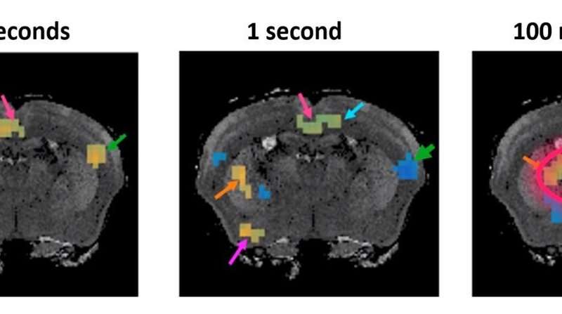 Fundamentally New MRI Method Developed To Measure Brain Function In Milliseconds