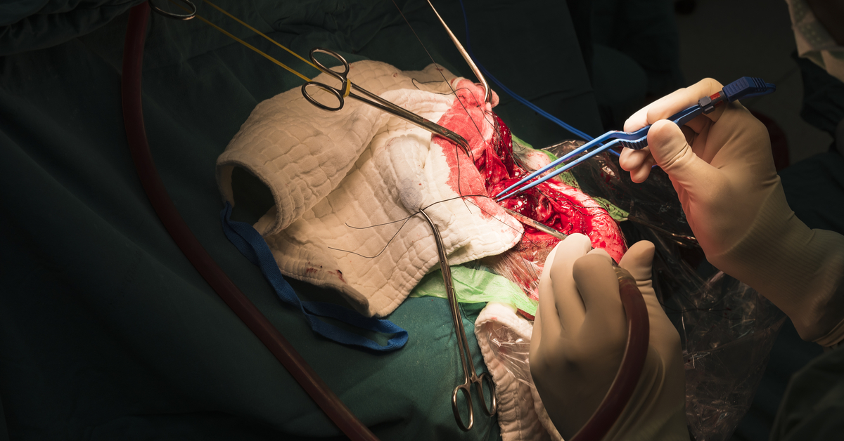 Awake Craniotomy For Brain Tumors: Preserving Brain Function While Maximizing Tumor Resection