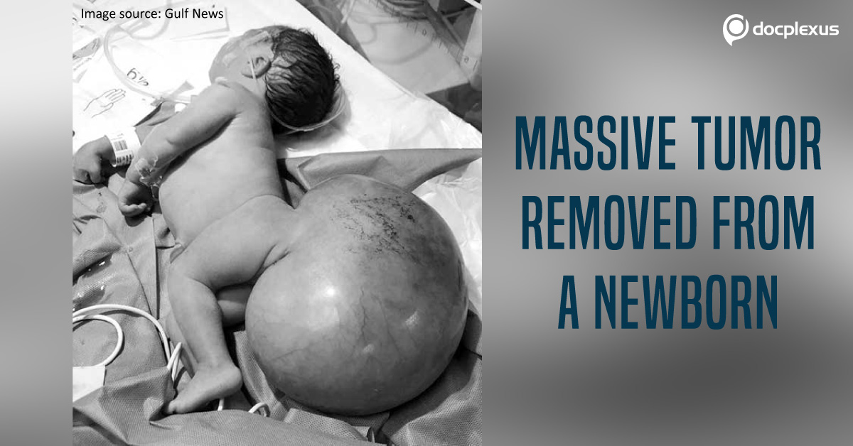 UAE Hospital Successfully Treats A Newborn With A Rare Congenital Defect