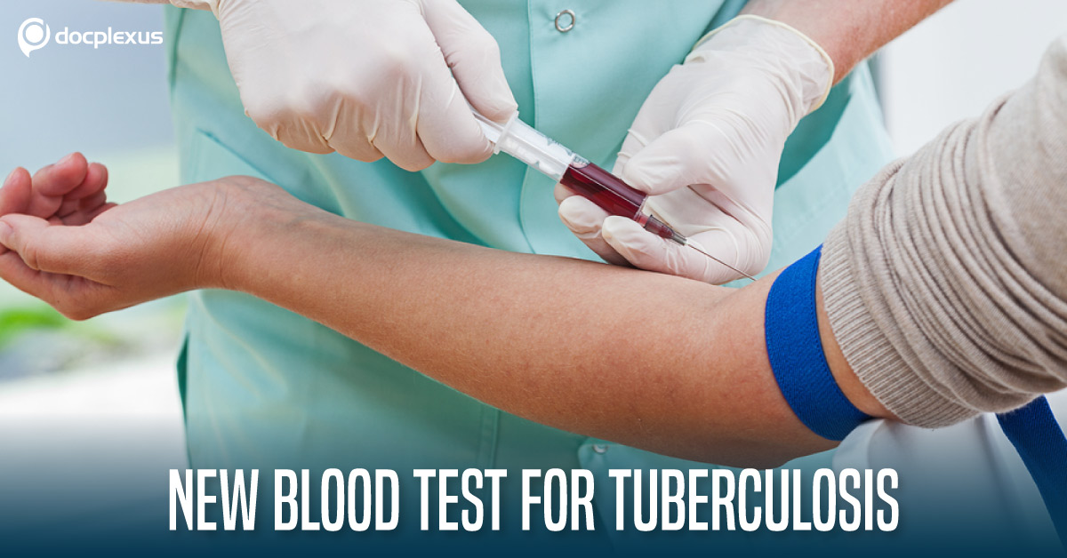 Looking Forward to a New and Simple Test for Tuberculosis