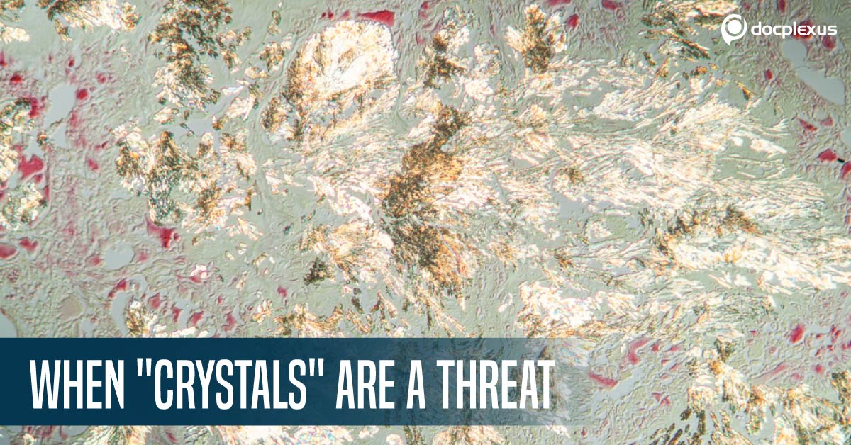 The Darker Side Of Shinny Crystals