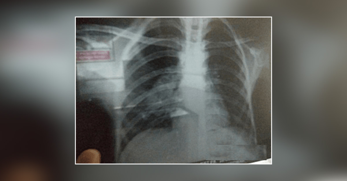 Help Me With The Diagnosis!