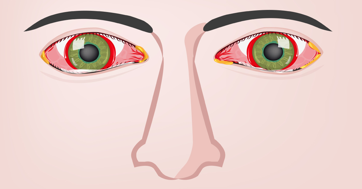 Some Of The Side Effects Of Ethambutol
