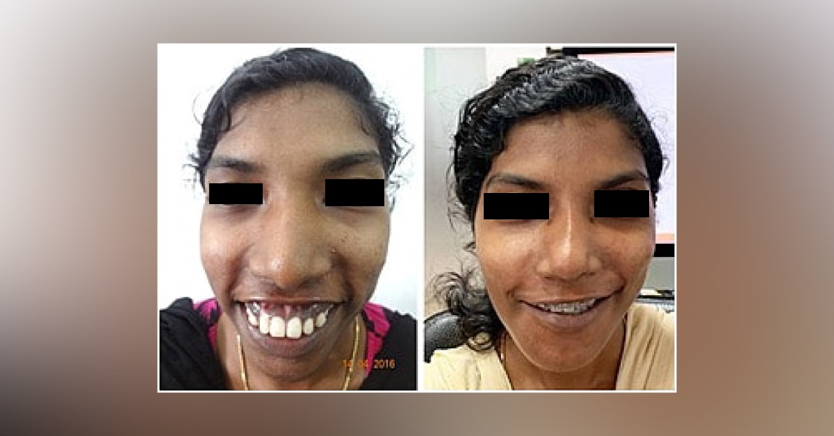 Facial Correction Surgery: Get Your Best Version Here
