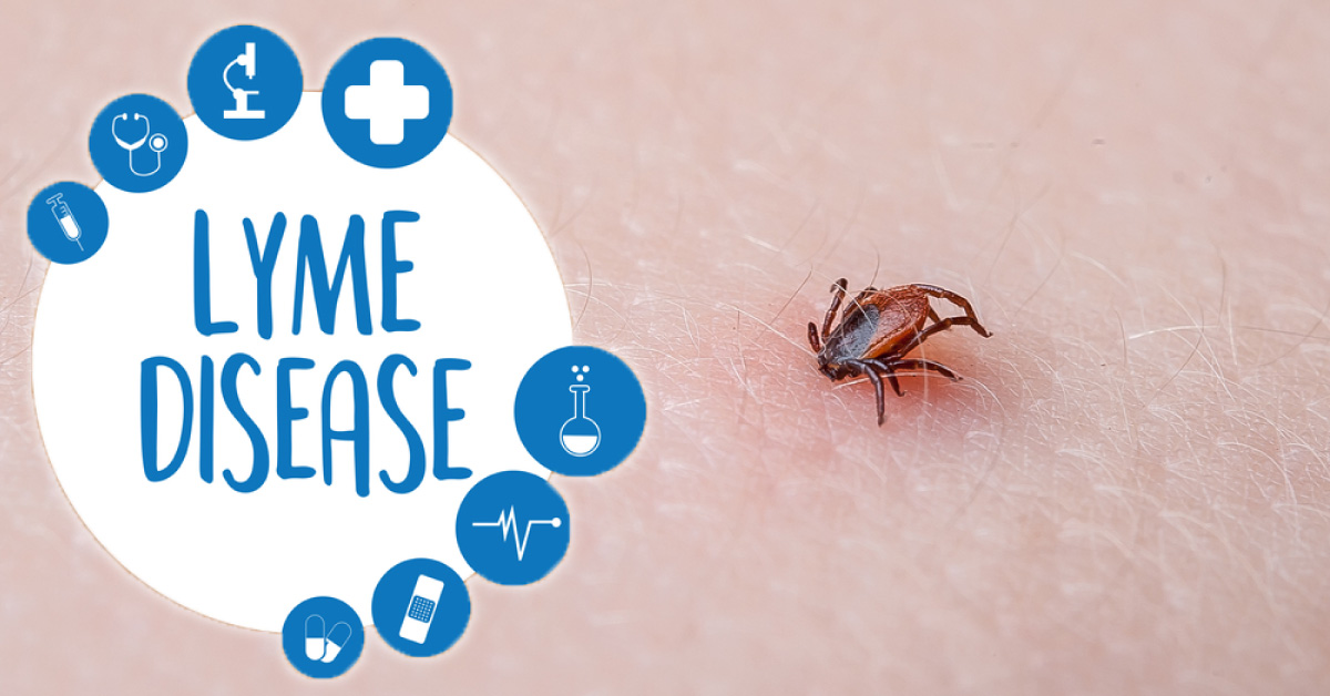 Ticks, Grassy Area And Lyme Disease
