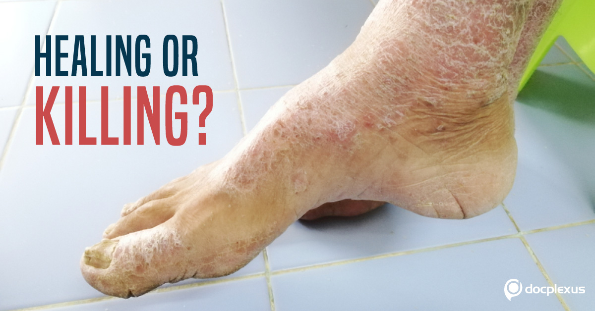 Should Hyaluronic Acid Be Contraindicated In Scleroderma?