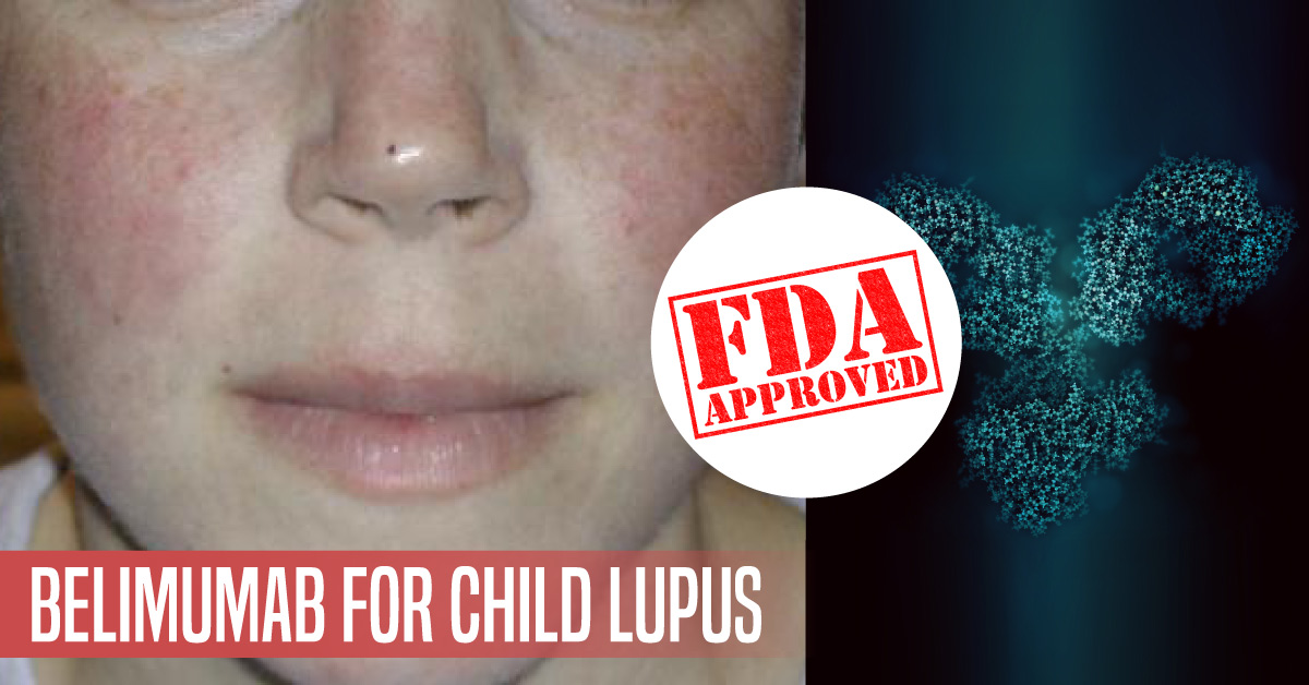 FDA Approves First Treatment For Children With Lupus