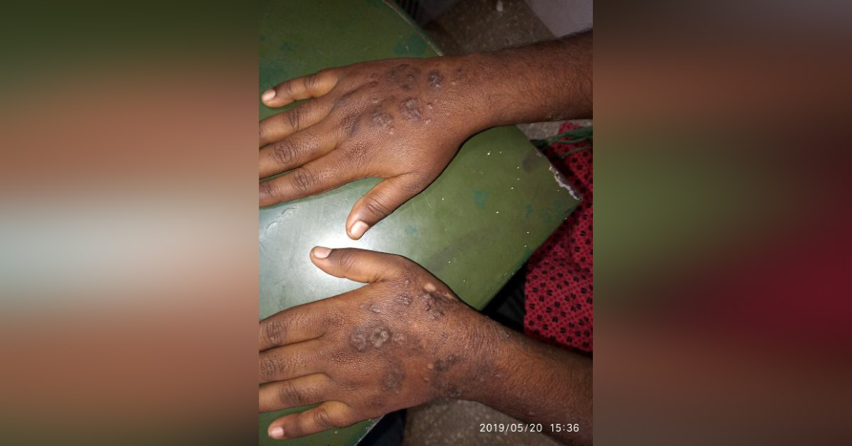 Identify The Condition