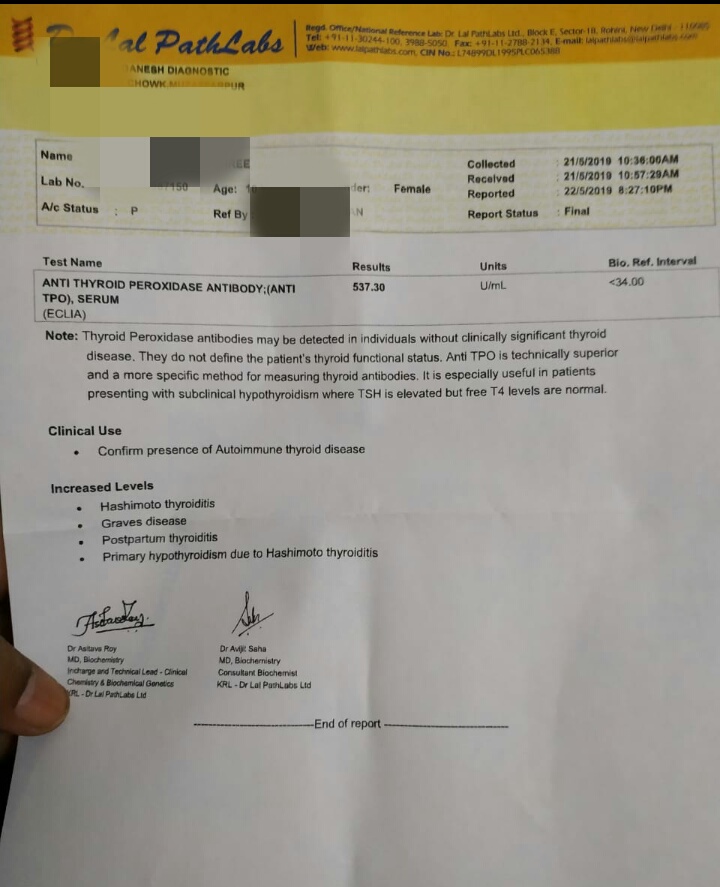 10 Year Old Girl Child With Hypothyroidism