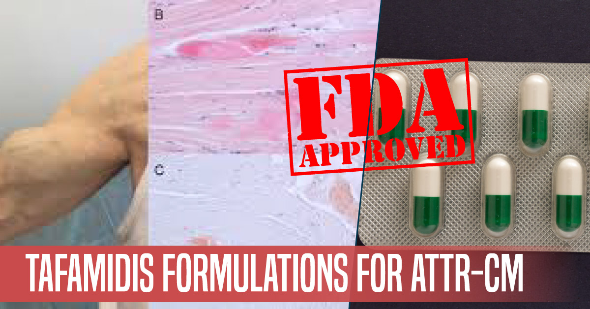 FDA Approved Tafamidis Formulation For Treating Rare Cardiovascular Disorder