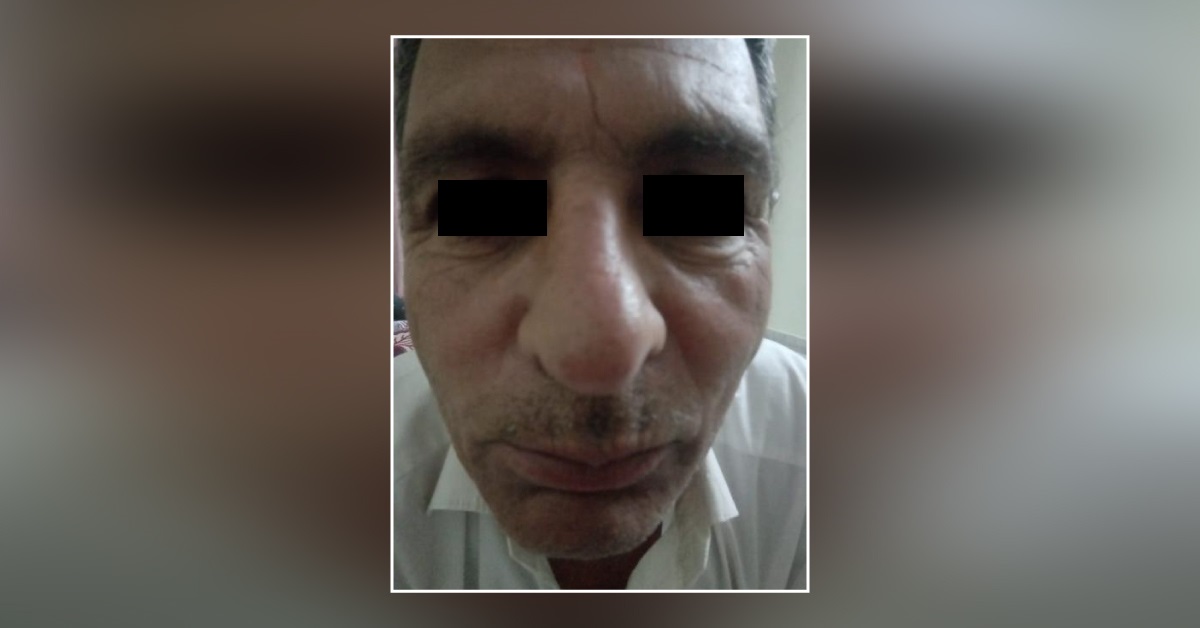 What Is The Treatment Of This Problem?