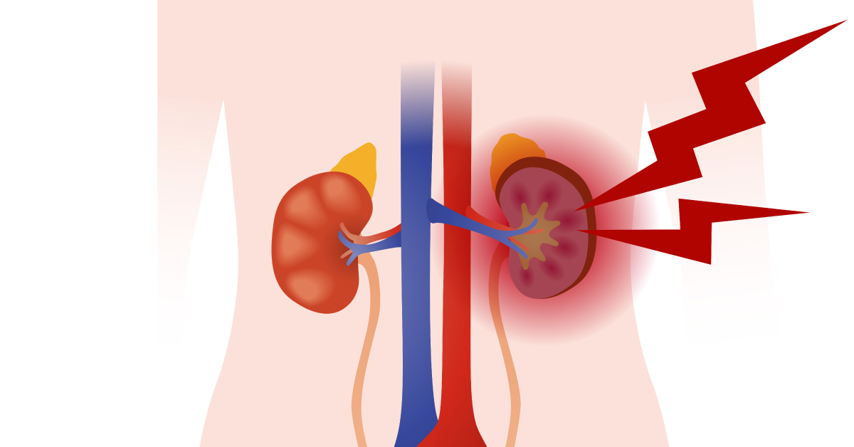 What Led to the Deterioration of Kidney Function?