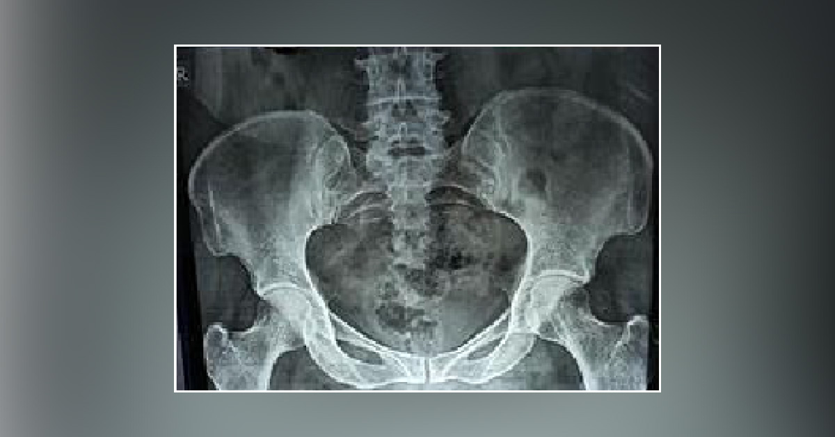 Are These X-Rays Culprit For Patients Symptoms?