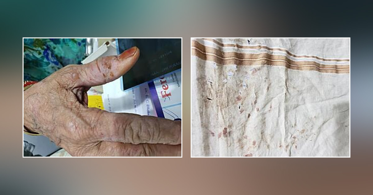 Surprising Phenomenon, What's Happening To Patient!