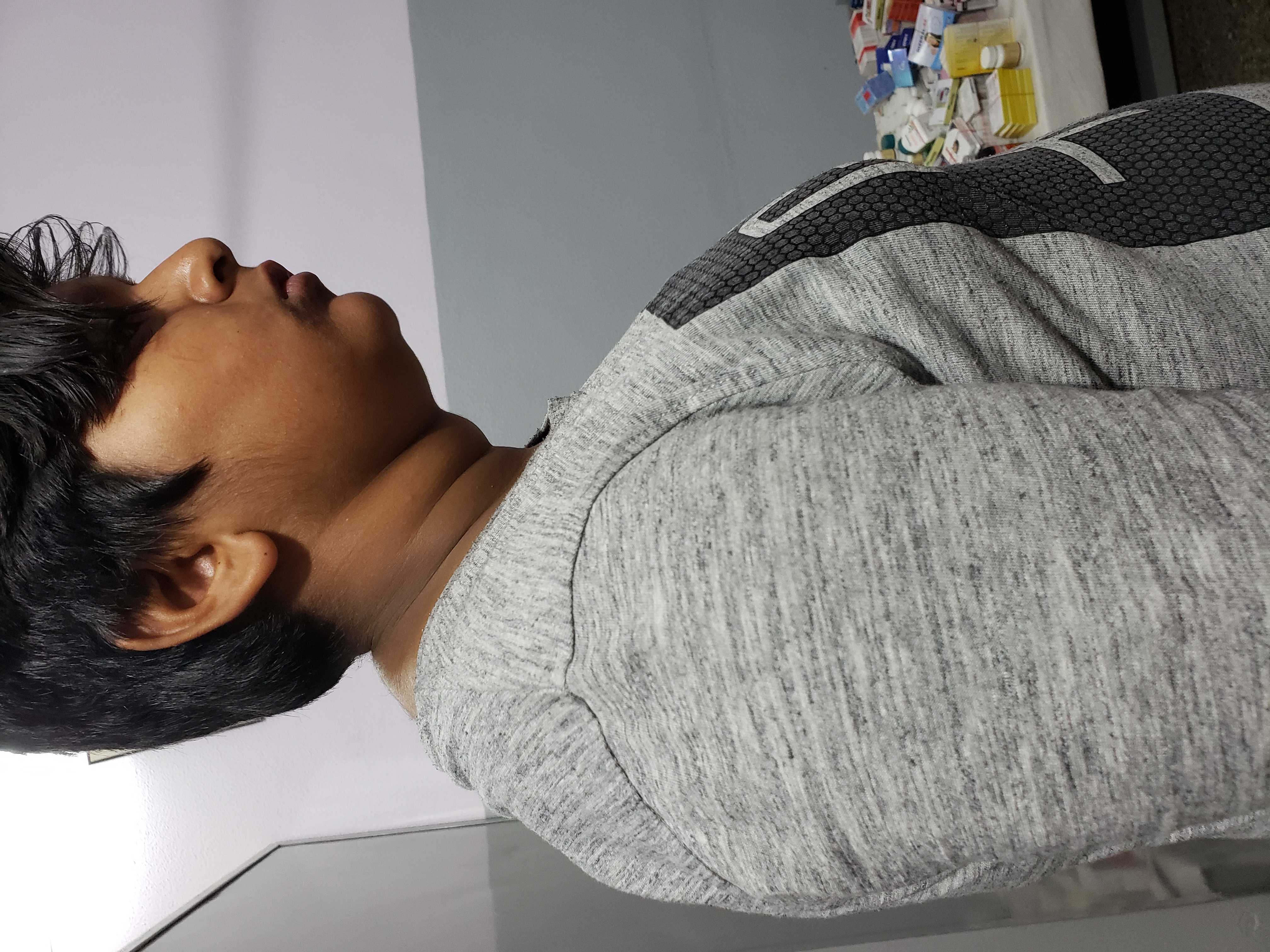 Is It Pituitary Deficiency Or Effect Of Steroid Inhalation In Infancy?