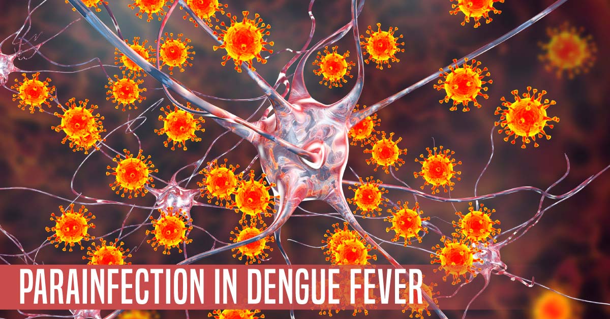 Neurotropism Of Dengue virus: Case Report
