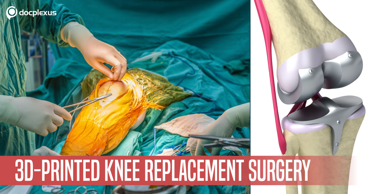 First Time Use Of 3D Technology For Knee Replacement Surgery In The GCC Region