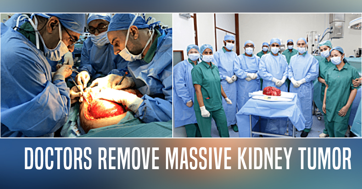 UAE Doctors Successfully Remove A Massive Kidney Tumor