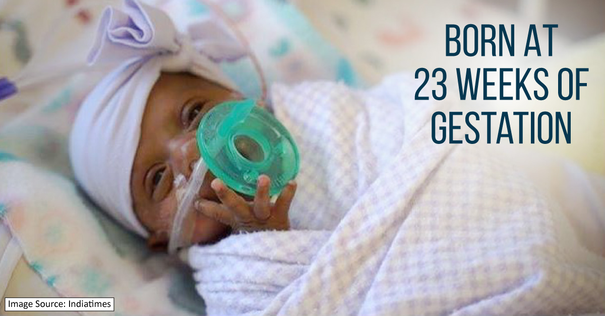World’s Tiniest Baby Born In California