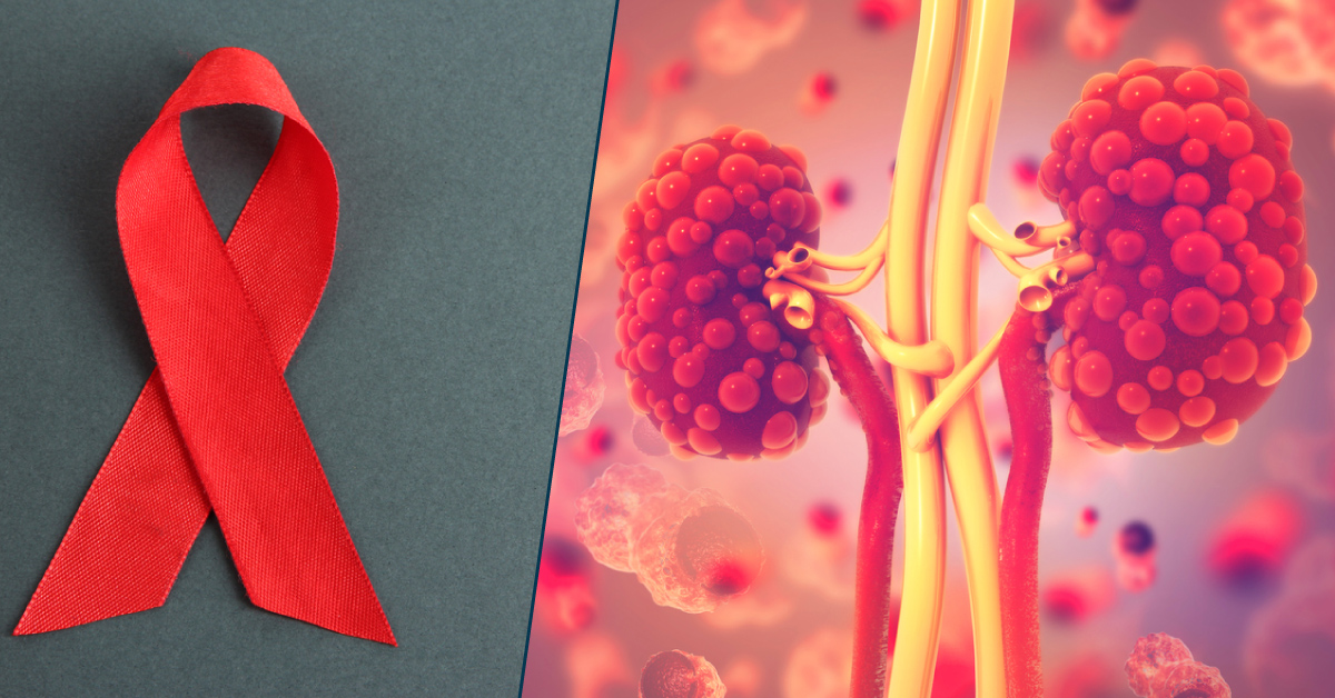 A 49-year-old Man with HIV, HCV, T2DM, and CKD: A Case Study