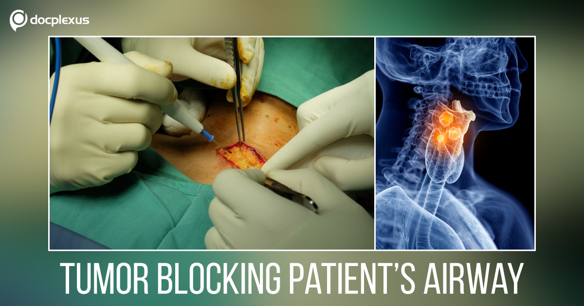 Dubai Hospital Surgeons Perform A Life-Saving Surgery On A Patient With Larynx Cancer