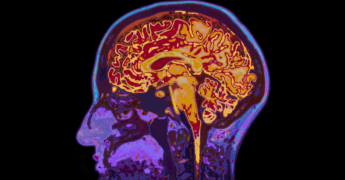 New Brain Imaging Study Reveals Signs Of Parkinson’s Decades Before Symptoms Appear