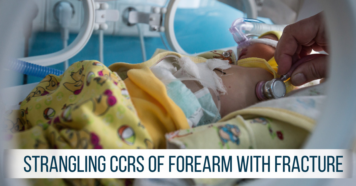 Forearm Fracture Due to Amniotic Band in a Neonate