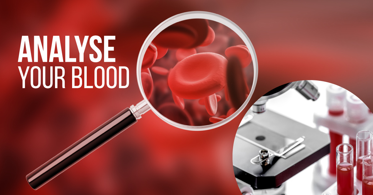 A Diagnostic Approach to Anemia
