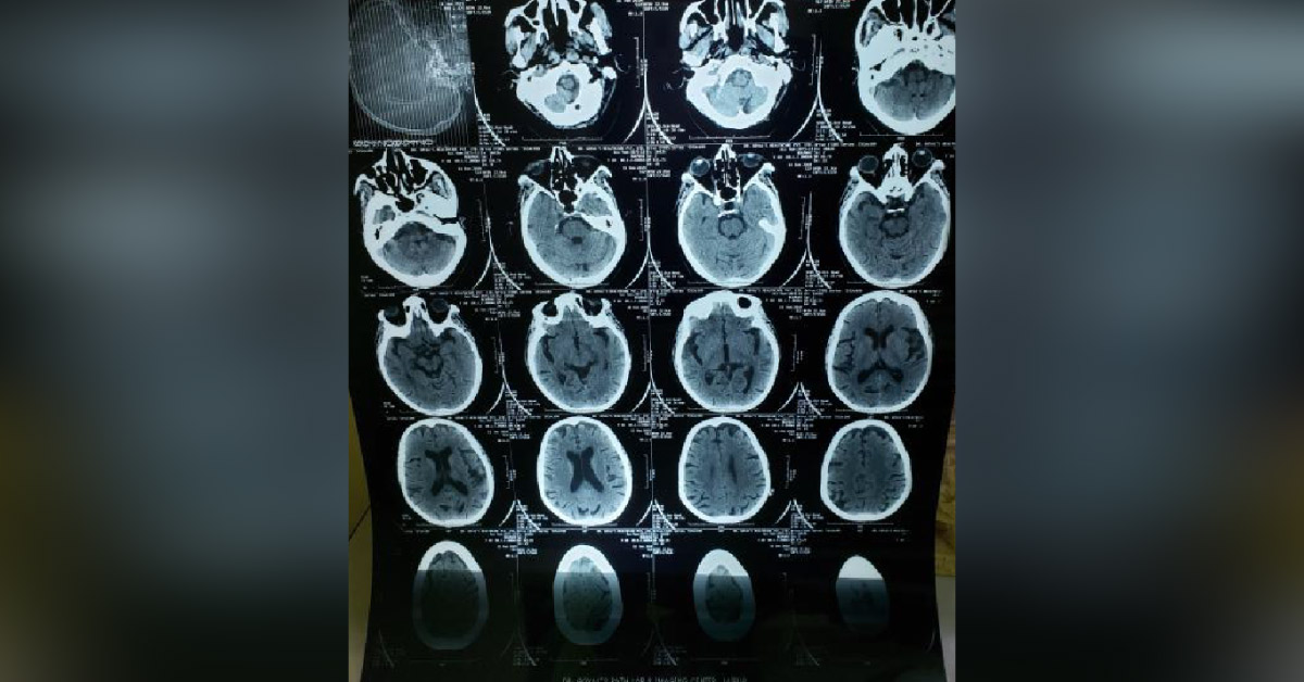  Opposite Therapy, See ,What Happened To Patient?