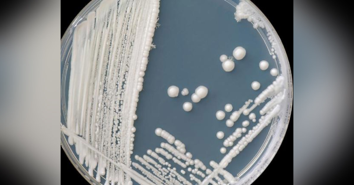 'Starving' Fungus Of Iron May Treat Drug-resistant Infection