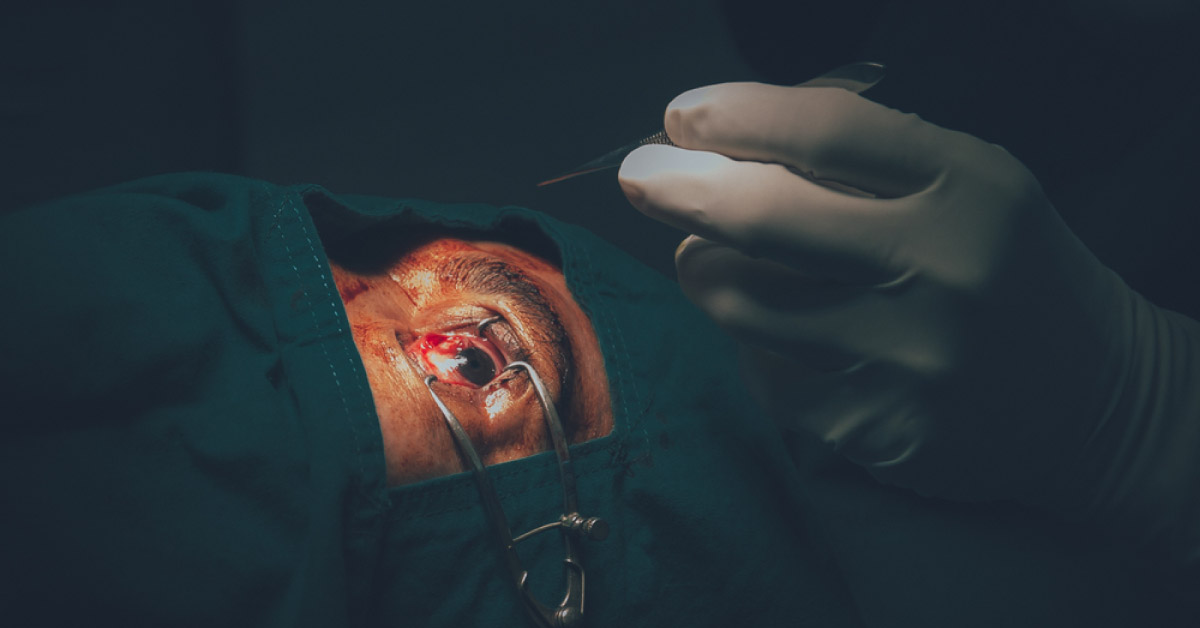 Indications Of Pterygium Surgery