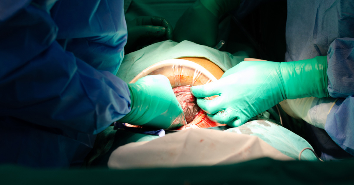 Can An Average Earning  Woman Afford Caesarian Delivery In Private Hospitals?