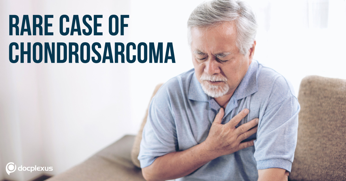 Chondrosarcoma: A Rare Primary Malignant Tumor of the Chest Wall