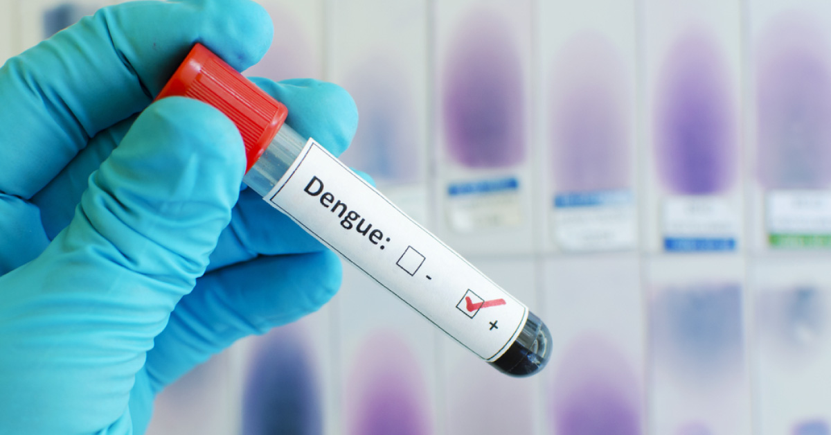 Dengue Fever Complication