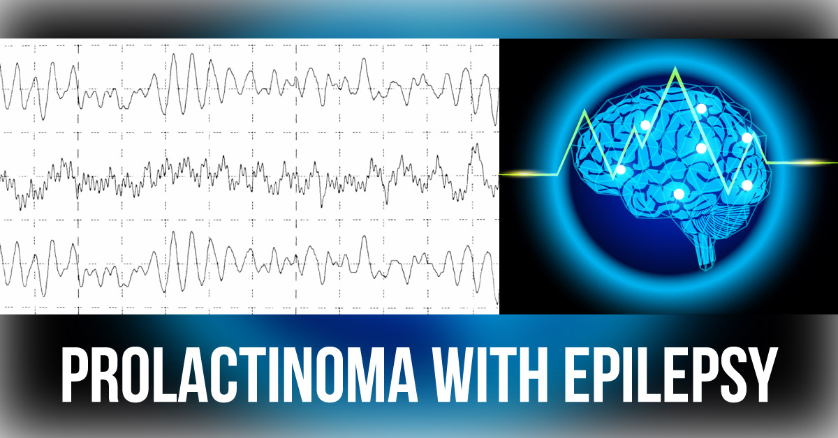 A Case Study Of Giant PRLoma With Status Epilepticus
