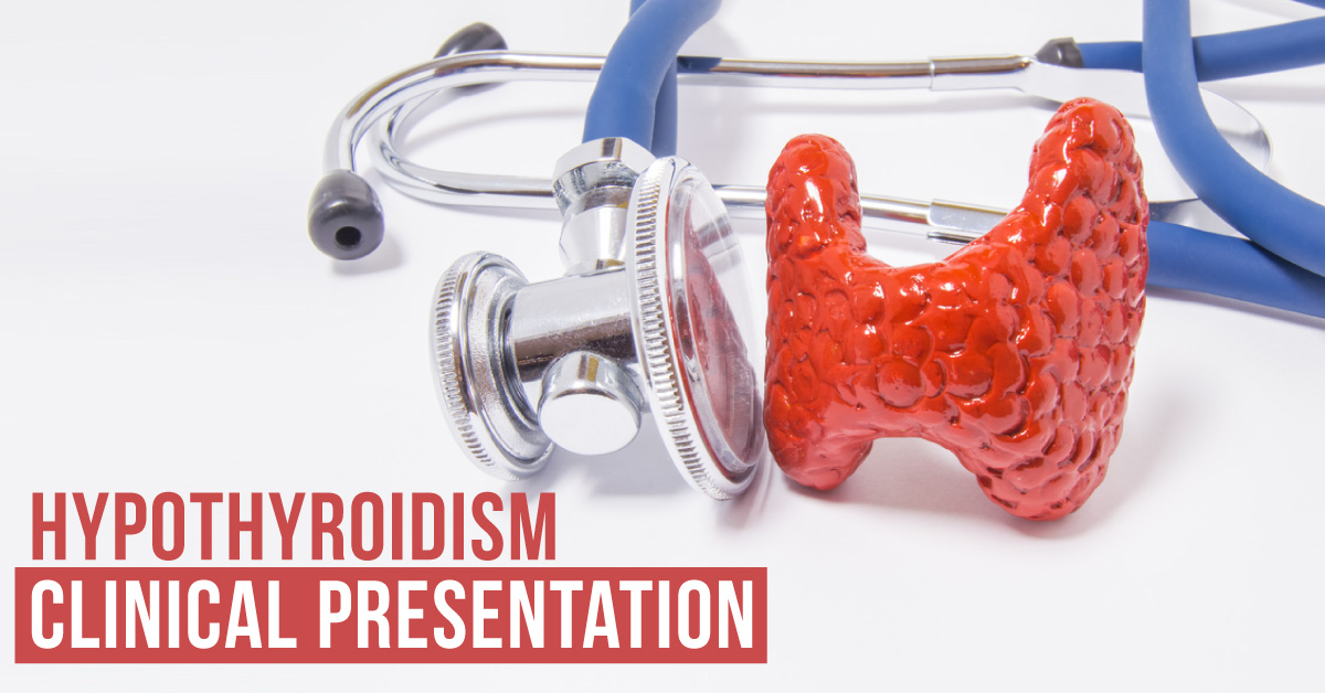 Clinical Presentation of Hypothyroidism