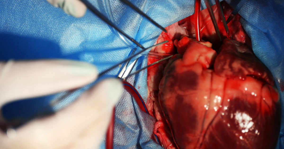 Cardiology- Need For Subspeciality