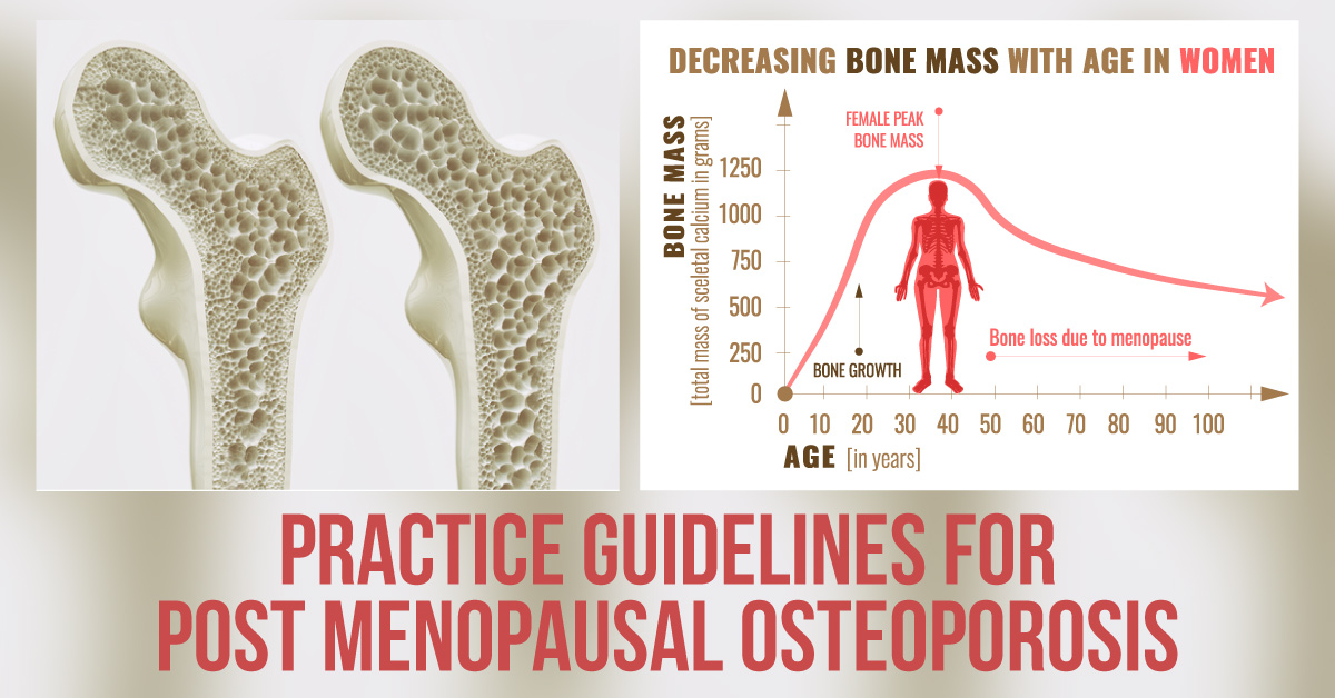 Osteoporosis in Post-Menopausal Women : Endocrine Society Clinical Practice Guidelines (2019)