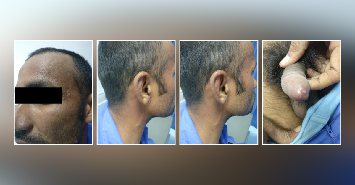 Interesting Shiny Skin Case