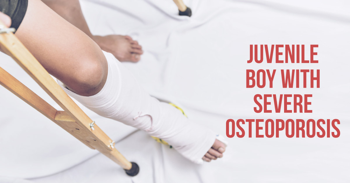 A case study of Bisphosphonate induced Atypical Femur fractures