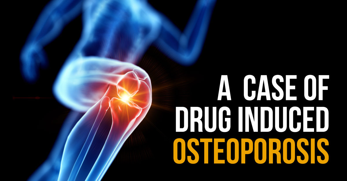 Hyperthyroidism Drug-induced Osteoporosis